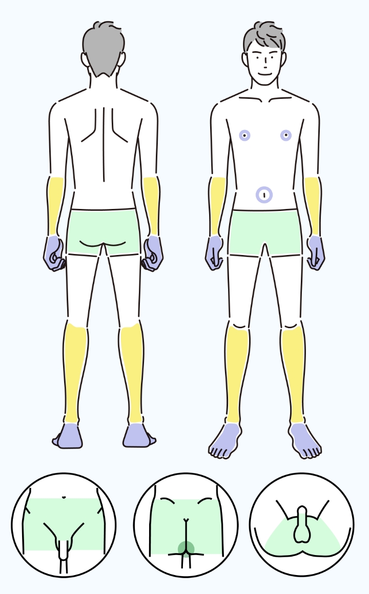 パーツ脱毛イメージ