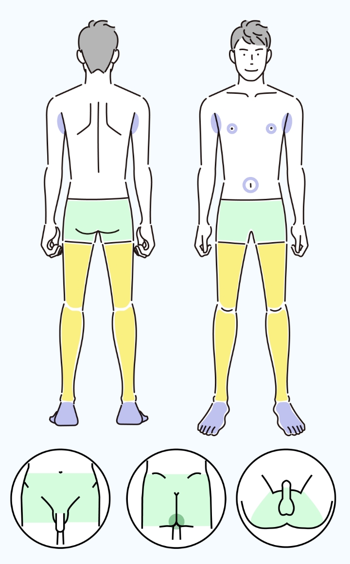 パーツ脱毛イメージ