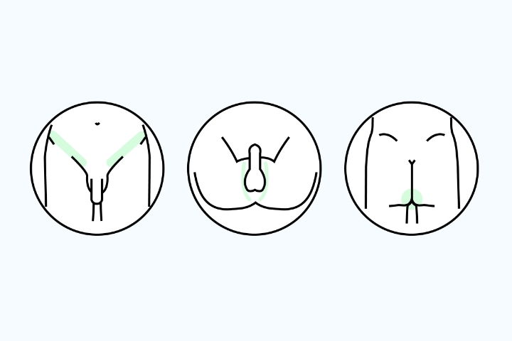 VIO脱毛イメージ