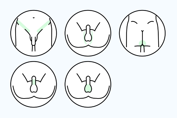 VIO脱毛イメージ