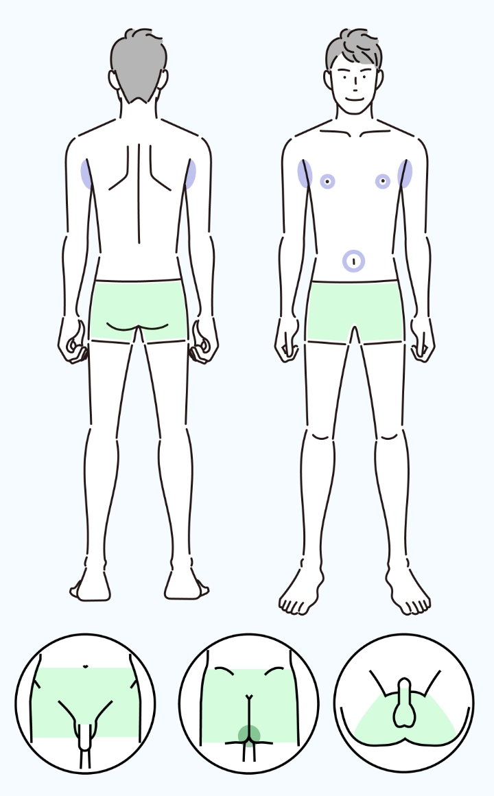 VIO脱毛イメージ